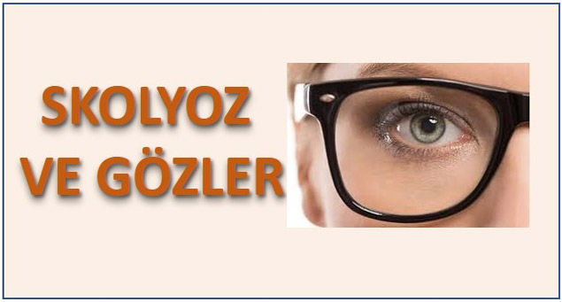 Skolyoz ve Gözler